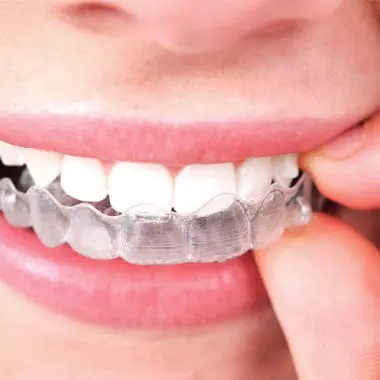 Invisalign Teen in Mount Kisco NY