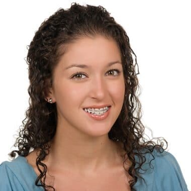 What Happens When I Get My Braces Removed?