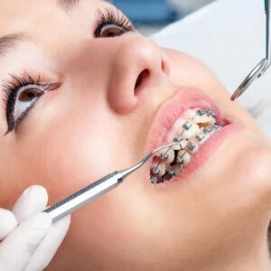 Braces treatment for adults